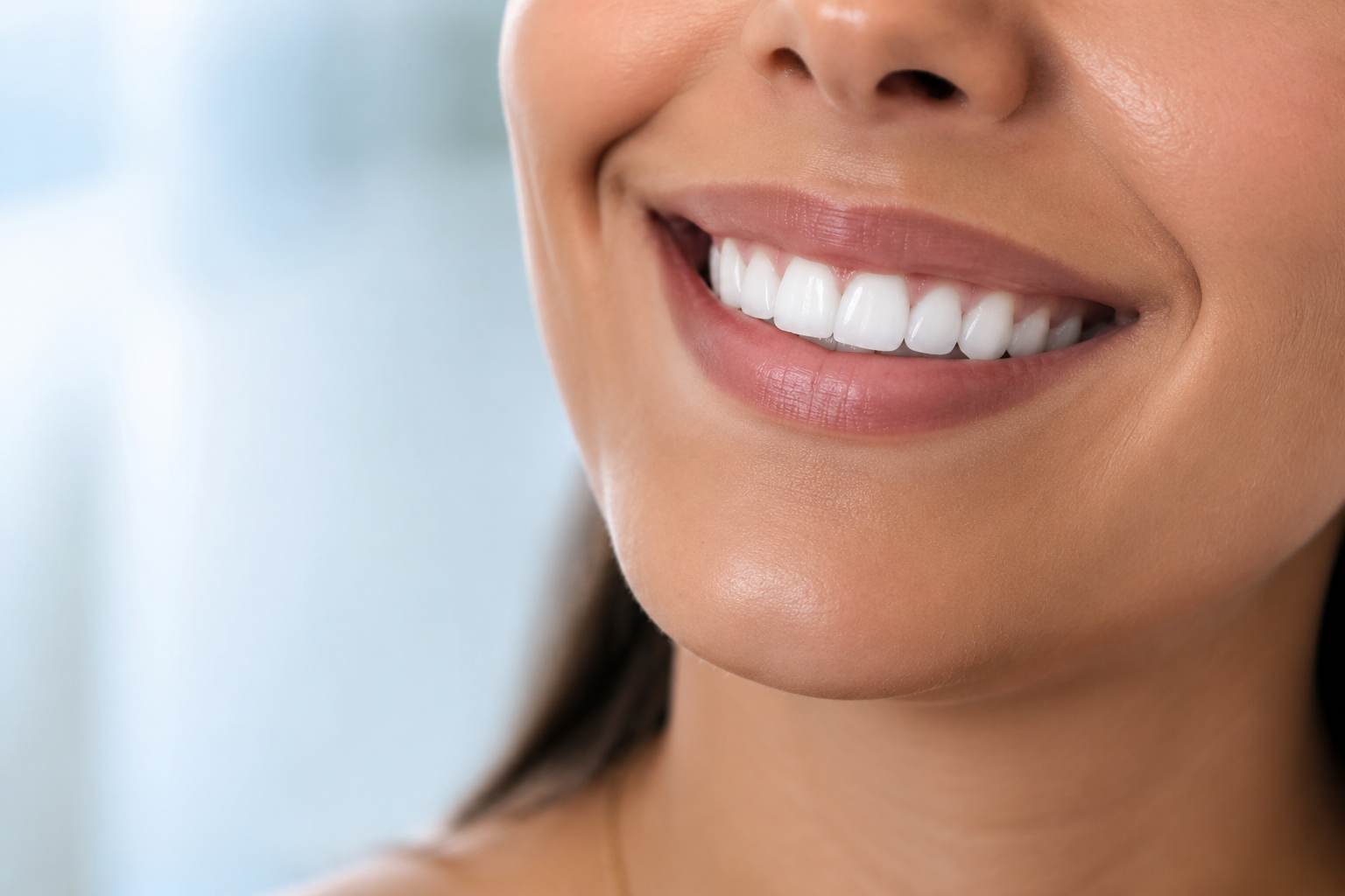Sorriso natural com facetas em resina